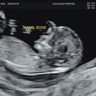 KakaoTalk_20241204_121200935